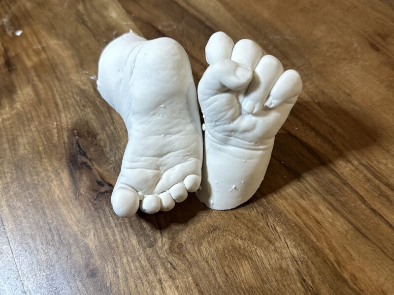Hand and foot castings