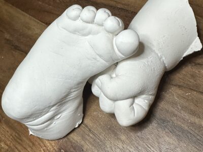 Hand and foot castings